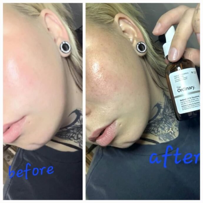 The Ordinary Sérum Retinol 1% in Squalane 30ml – Image 4